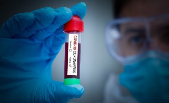 covid-19, regroupement de crédits